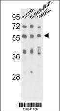 Anti-MECP2 Rabbit Polyclonal Antibody (AP (Alkaline Phosphatase))