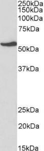 Anti-NR5A2 Antibody (A82732) (1 µg/ml) staining of HepG2 lysate (35 µg protein in RIPA buffer) Primary incubation was 1 hour Detected by chemiluminescence