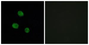 Immunofluorescence analysis of MCF7 cells using Anti-hnRNP M Antibody. The right hand panel represents a negative control, where the antibody was pre-incubated with the immunising peptide.