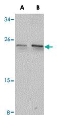 Anti-CCDC134 Rabbit Polyclonal Antibody