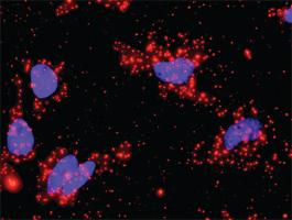 Anti-HSPB1 + MAPKAPK3 Antibody Pair