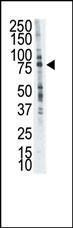 Anti-LTK Rabbit Polyclonal Antibody (PE (Phycoerythrin))