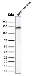 Anti-LI Cadherin Mouse Monoclonal Antibody [clone: CDH17/2617]