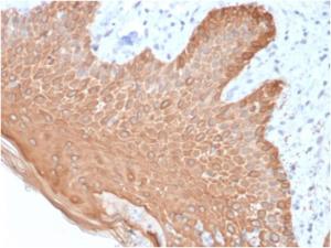 Immunohistochemical analysis of formalin-fixed, paraffin-embedded human skin using Anti-pan Cytokeratin Antibody [rKRT/457]