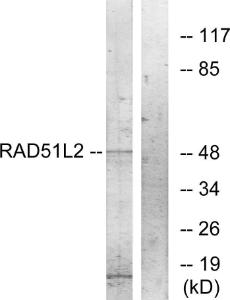 Western blot analysis of lysates from COS7 cells using Anti-RAD51L2 Antibody. The right hand lane represents a negative control, where the antibody is blocked by the immunising peptide.