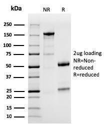 SDS-PAGE analysis of Anti-PD-L1 Antibody [PDL1/2746] under non-reduced and reduced conditions; showing intact IgG and intact heavy and light chains, respectively SDS-PAGE analysis confirms the integrity and purity of the antibody