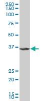 Anti-CIAPIN1 Mouse Polyclonal Antibody