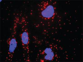 Anti-KLK3 + AR Antibody Pair