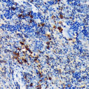 Immunohistochemistry analysis of paraffin-embedded mouse spleen using Anti-CSK Antibody [ARC1835] (A307712) at a dilution of 1:100 (40x lens). Perform microwave antigen retrieval with 10 mM Tris/EDTA buffer pH 9.0 before commencing with IHC staining protocol.