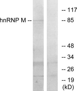 Western blot analysis of lysates from HT-29 cells using Anti-hnRNP M Antibody. The right hand lane represents a negative control, where the antibody is blocked by the immunising peptide.