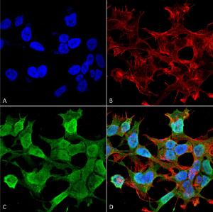 Immunocytochemistry/Immunofluorescence analysis of human neuroblastoma cell line (SK-N-BE, fixed in 4% formaldehyde for 15 min at room temperature, using Anti-Neuroligin 1 Antibody [S97A-31] (A304803), at 1:100 for 60 minutes at room temperature