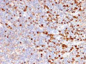 Immunohistochemical analysis of formalin-fixed, paraffin-embedded human tonsil using Anti-TIM3 Antibody [TIM3/2399]