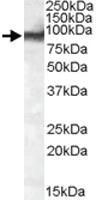 Anti-EWSR1 Goat Polyclonal Antibody