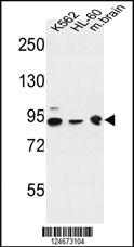 Anti-DNAJC6 Rabbit Polyclonal Antibody