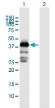 Anti-MAGEA3 Rabbit Polyclonal Antibody