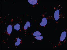 Anti-LAMA5 + LAMC1 Antibody Pair