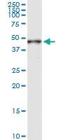 Anti-MAGEA3 Rabbit Polyclonal Antibody