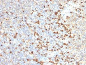 Immunohistochemical analysis of formalin-fixed, paraffin-embedded human tonsil using Anti-TIM3 Antibody [TIM3/2399]