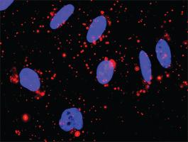 Anti-MAPK13 + MAPKAPK3 Antibody Pair