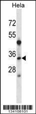 Anti-LAT2 Rabbit Polyclonal Antibody (FITC (Fluorescein Isothiocyanate))