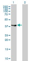 Anti-ASRGL1 Rabbit Polyclonal Antibody