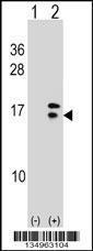 Anti-CRABP2 Rabbit Polyclonal Antibody (AP (Alkaline Phosphatase))