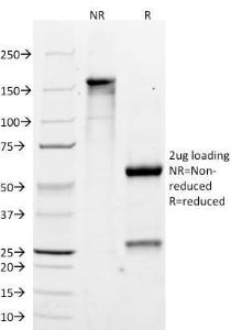 SDS-PAGE analysis of Anti-MelanA Antibody [M2-7C10] under non-reduced and reduced conditions; showing intact IgG and intact heavy and light chains, respectively. SDS-PAGE analysis confirms the integrity and purity of the Antibody