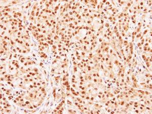 Anti-HIST3H3 Rabbit Polyclonal Antibody