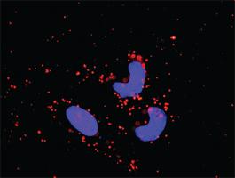 Anti-MAPK14 + MAPKAPK2 Antibody Pair