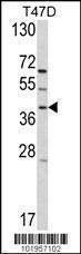 Anti-GPRC5A Rabbit Polyclonal Antibody