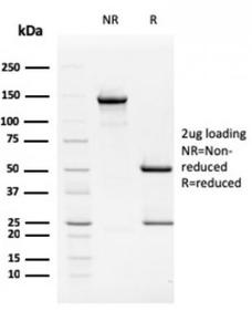 SDS-PAGE analysis of Anti-TIM3 Antibody [TIM3/2399] under non-reduced and reduced conditions; showing intact IgG and intact heavy and light chains, respectively. SDS-PAGE analysis confirms the integrity and purity of the antibody