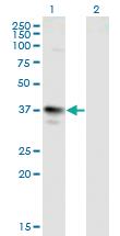 Anti-MAGEA3 Mouse Monoclonal Antibody [clone: 6D10]