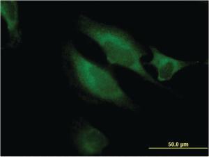 Anti-RAB9B Mouse Monoclonal Antibody [clone: 3C9]