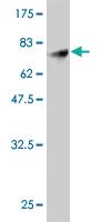 Anti-FLI1 Mouse Monoclonal Antibody [clone: 1H4]