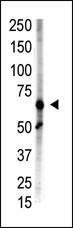 Anti-ZMIZ1 Rabbit Polyclonal Antibody (AP (Alkaline Phosphatase))