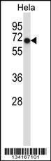 Anti-ACVR1 Rabbit Polyclonal Antibody (APC (Allophycocyanin))