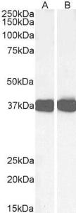 Anti-Arg1 Antibody (A84319) (005 µg/ml) staining of Mouse Liver (A) and Rat Liver (B) lysates (35 µg protein in RIPA buffer) Detected by chemiluminescence