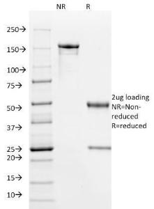 SDS-PAGE analysis of Anti-HPV16 E6 Antibody [HPV16/1295] under non-reduced and reduced conditions; showing intact IgG and intact heavy and light chains, respectively. SDS-PAGE analysis confirms the integrity and purity of the antibody.