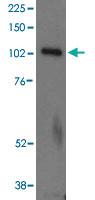 Anti-UNC13D Goat Polyclonal Antibody