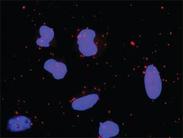 Anti-MAPK14 + MAPKAPK3 Antibody Pair