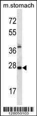 Anti-ALKBH4 Rabbit Polyclonal Antibody (HRP (Horseradish Peroxidase))