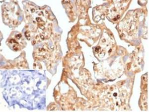 Immunohistochemical analysis of formalin-fixed, paraffin-embedded human placenta using Anti-alpha Fetoprotein Antibody [AFP/7007R] at 2µg/ml in PBS for 30 minutes at room temperature. Inset: PBS instead of the primary antibody. Secondary antibody negative control.