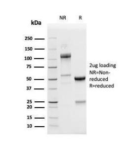 SDS-PAGE analysis of Anti-PD-L1 Antibody [PDL1/4280R] under non-reduced and reduced conditions; showing intact IgG and intact heavy and light chains, respectively. SDS-PAGE analysis confirms the integrity and purity of the Antibody