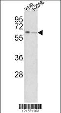 Anti-FPGS Rabbit Polyclonal Antibody