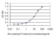 Anti-MAGEA3 Mouse Monoclonal Antibody [clone: 6D10]