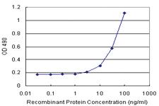 Anti-DDC Polyclonal Antibody Pair