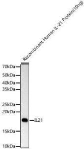 Western blot analysis of Recombinant Human IL-21 Protein(10ng), using Anti-IL-21 Antibody [ARC60383] (A309923) at 1:2000 dilution