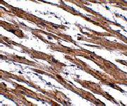 Anti-NAA35 Rabbit Polyclonal Antibody