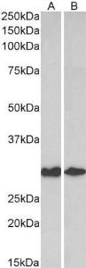 Anti-LGALS3 Antibody (A84321) (0.3 µg/ml) staining of Human (A) and Mouse (B) Colon lysates (35 µg protein in RIPA buffer). Primary incubation was 1 hour. Detected by chemiluminescence