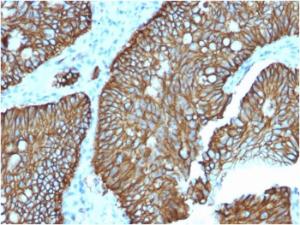 Immunohistochemical analysis of formalin-fixed, paraffin-embedded human colon using Anti-LI Cadherin Antibody [CDH17/2618]